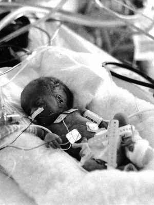 Emily in the NICU (1997)
